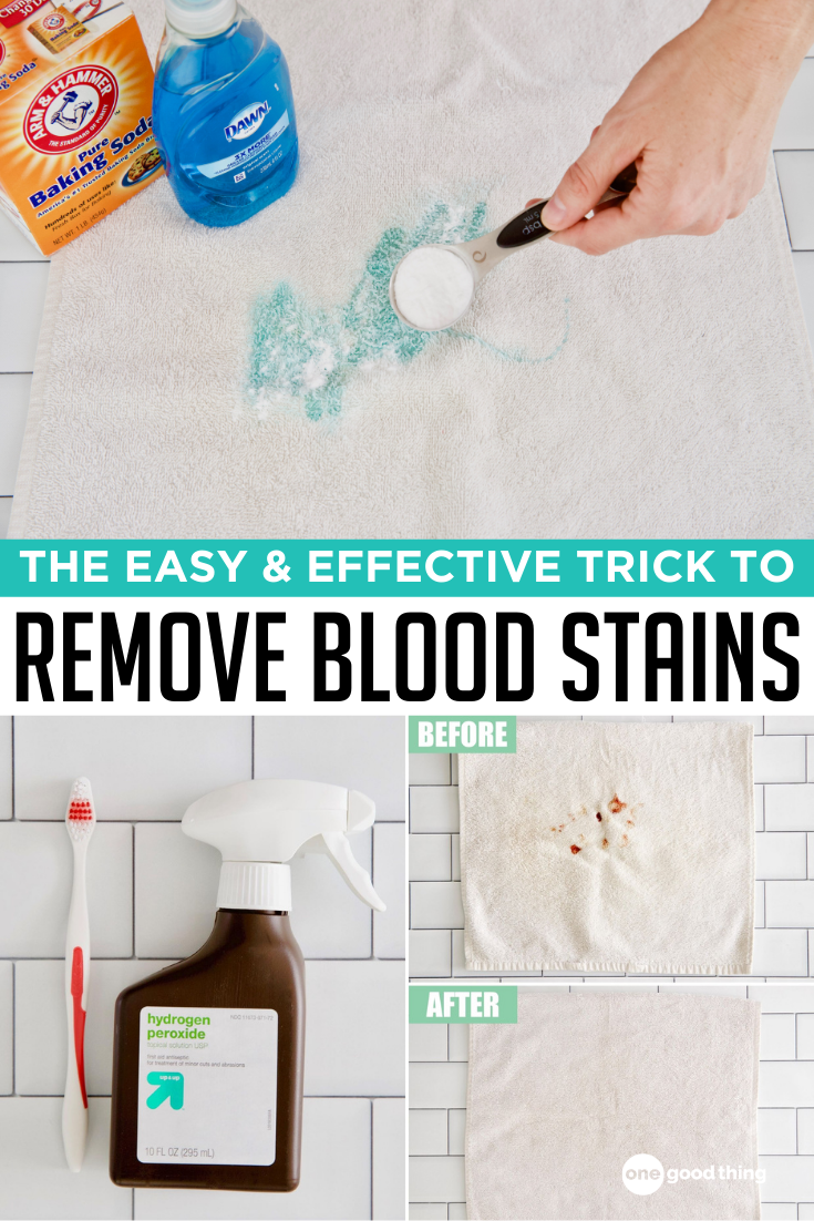 How to Remove Blood Stains from Mattress? Solve Your Troubles in a Few Steps缩略图